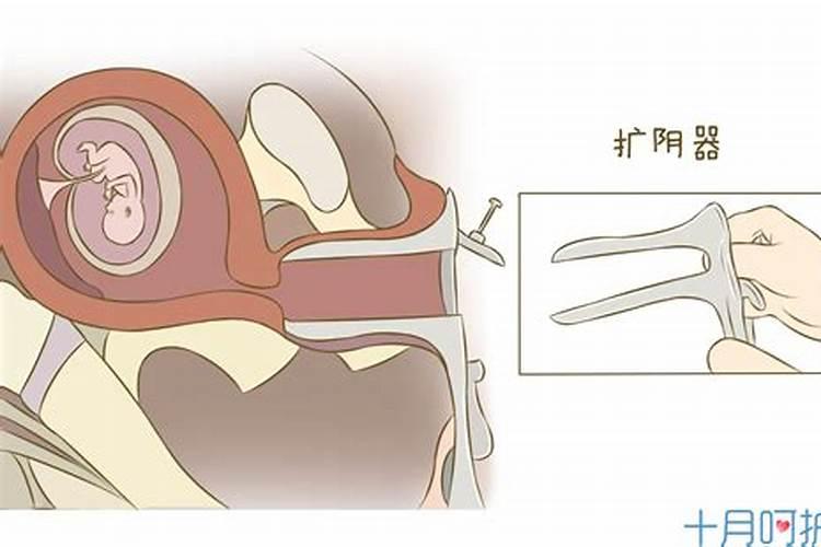 堕胎的孩子托梦是什么