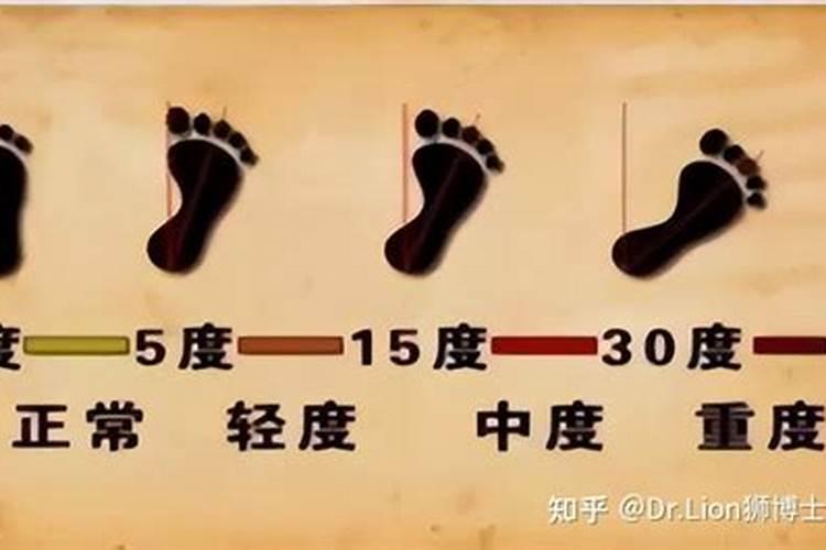 梦见猫咬我然后我把猫杀了的预兆