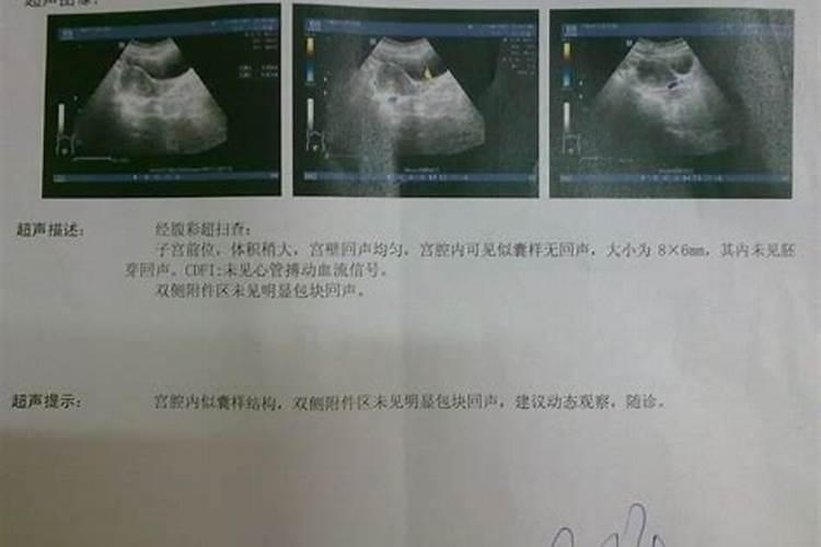 怀孕一个月可以打胎吗？  百度宝宝知道