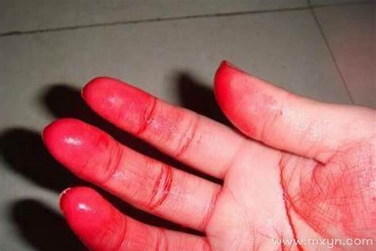 女人梦见手流血是吉兆