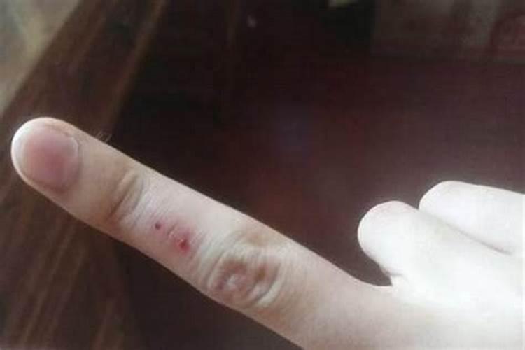 梦见手破了出血了的预兆