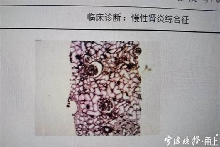 梦见自己和前男友好了还生来孩子了