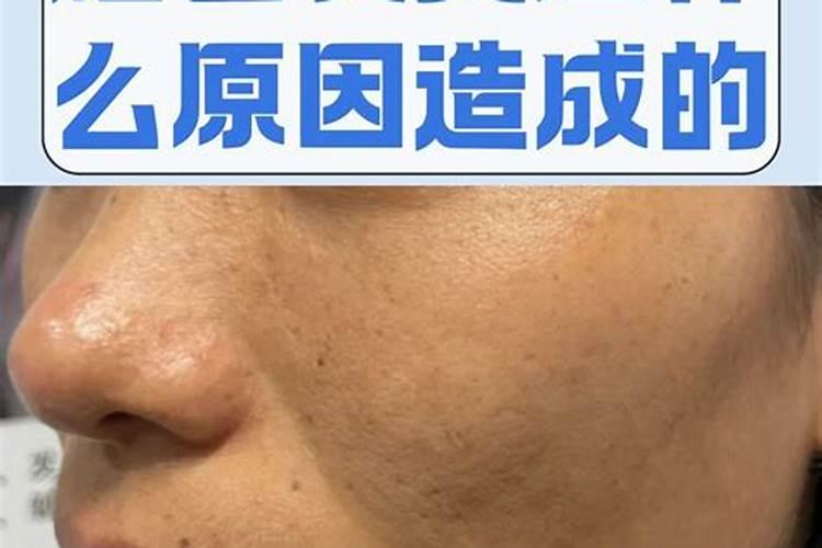 梦到去世的人还活着