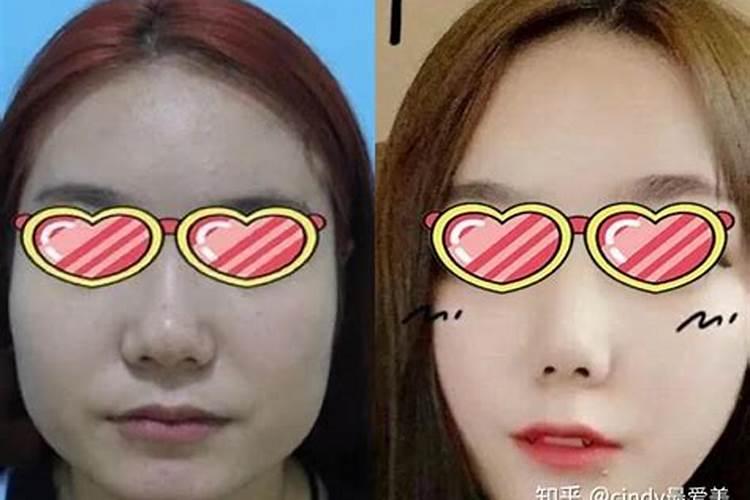 女生下颌角宽大面相,女人下颌骨宽大面相