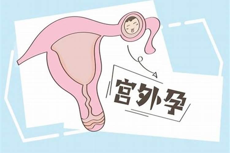堕胎有没有报应