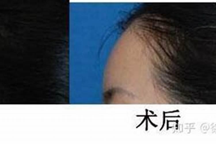 额头平的人命运怎么样 额头面相要怎么分析？