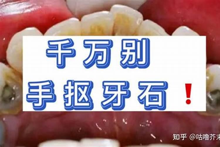 梦见牙结石被自己整块抠掉露出新牙？