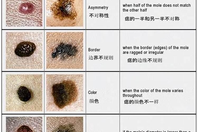 脚趾有痣的女人命运