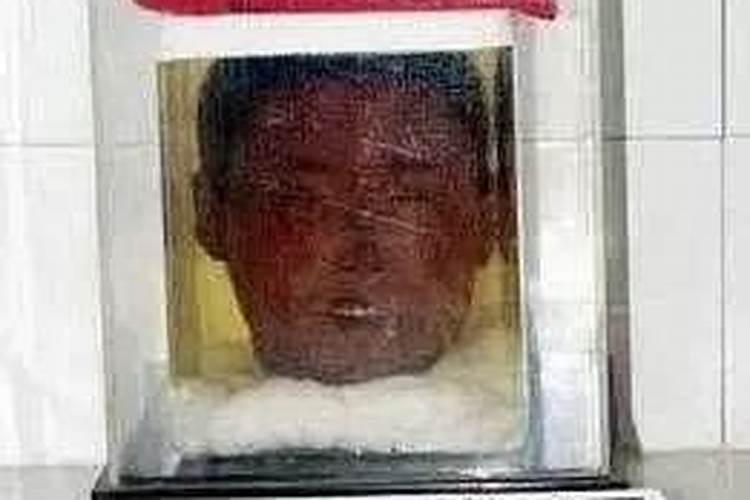 梦见死人头颅的预兆