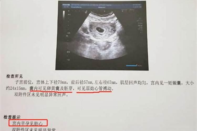 堕胎会影响运势么