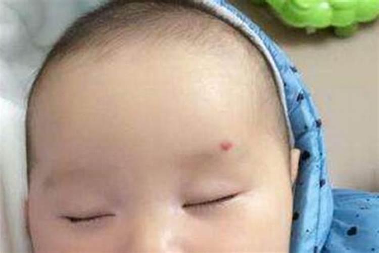 真童子的胎记长在什么位置