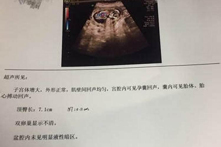 打掉的婴儿真的不能转世了吗  百度宝宝知道