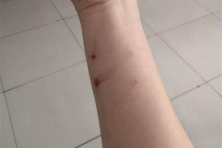 梦见被猫咬住手腕不放的预兆