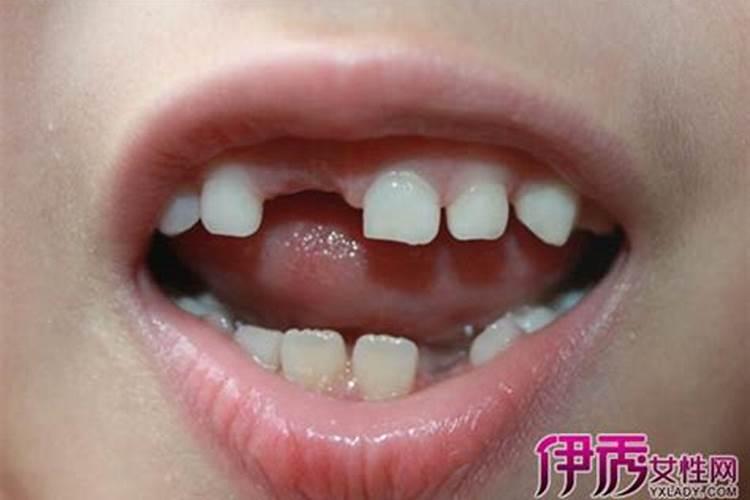 梦见儿子掉了一颗牙的预兆