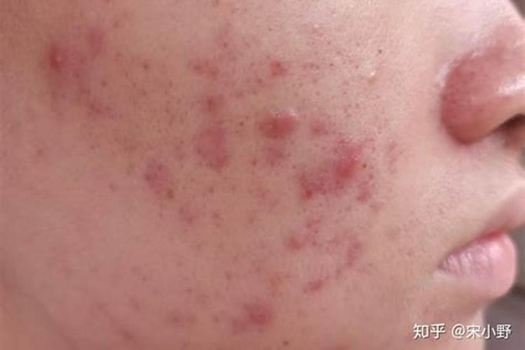 八字中官星被合贵气就没了吗