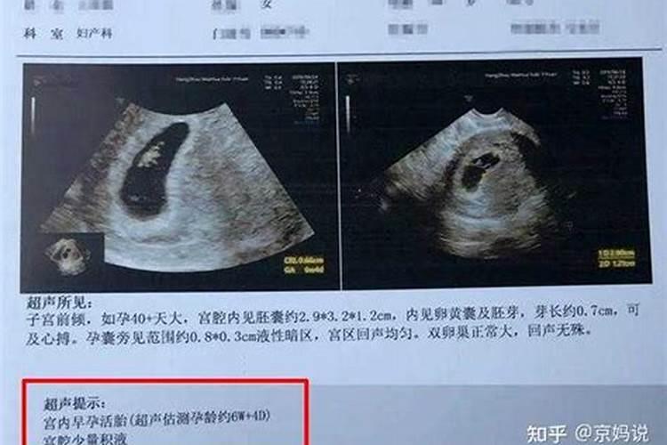 关于己堕胎的妈妈,应该如何做功德回向给无缘的孩子..