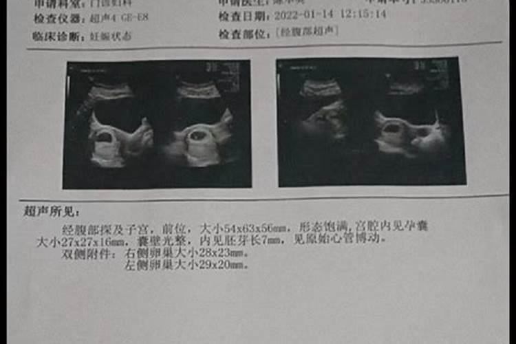 怀孕多久流产需要超度