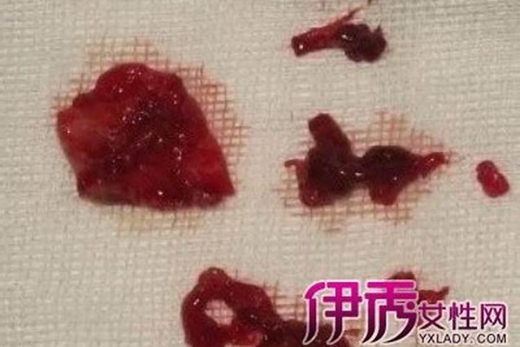 梦见来月经是什么征兆
