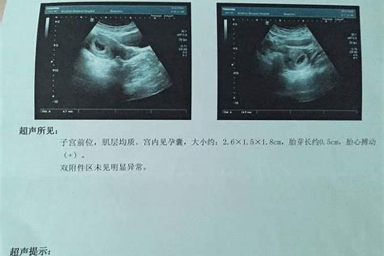 流产的婴儿有灵魂吗佛法莲蓬鬼话  百度宝宝知道