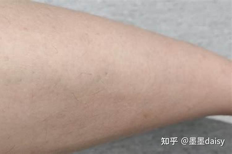 额头痣上长毛是福相还是凶相