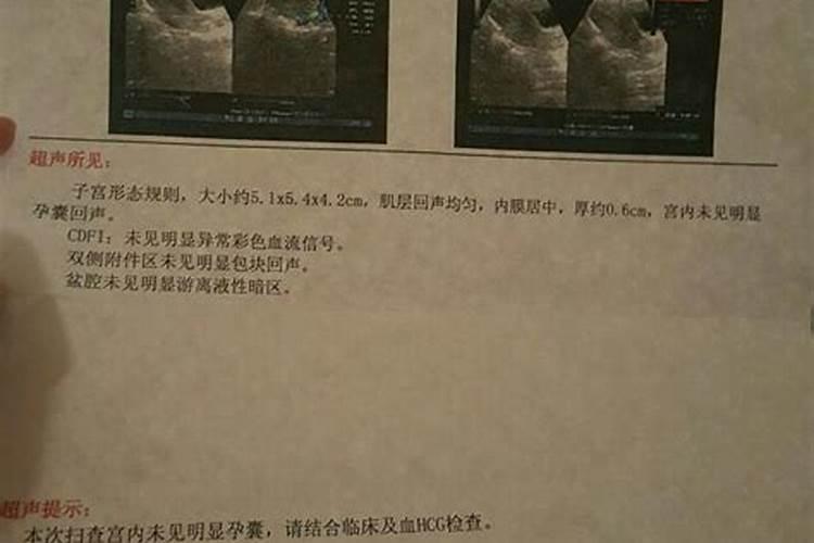 求大师解卦易经51卦。万分感谢。